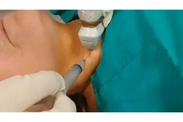 Adetliyken Biyopsi Yapılır mı?