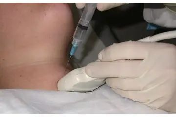 Guatr Biyopsi Nasıl Yapılır?