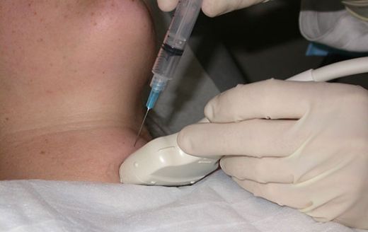 Biyopsi Riskleri Nelerdir?