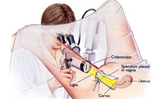 Rahim Biyopsi Nedir ve Nasıl Yapılır?