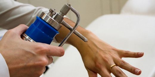 Servikal Biyopsi Nedir ve Nasıl Yapılır?