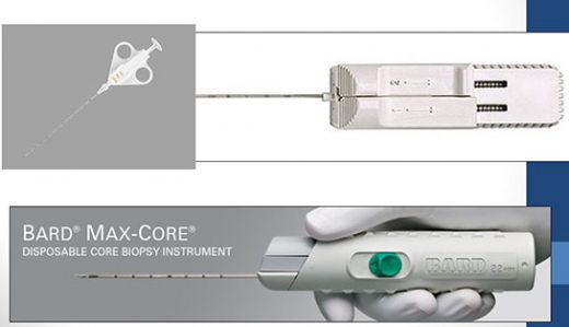 Tru Cut biyopsi Nasıl Uygulanır?